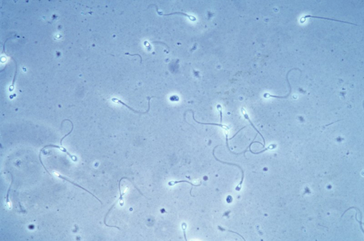 gelatin lumps in sperm